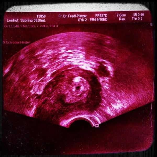 Bild zu Bibbern nach pos Test - Kinderwunschbehandlung