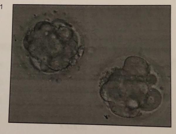 Bild zu Darf ich vorstellen: - Kinderwunschbehandlung