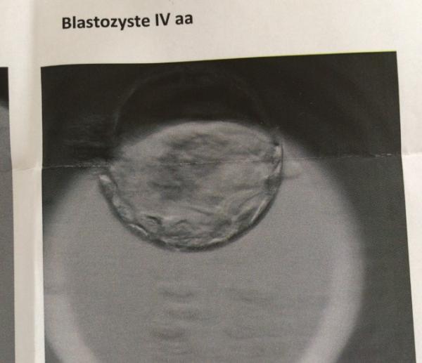 Bild zu Transfer heute - Kinderwunschbehandlung