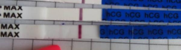 Bild zu 1 icsi schwanger bitte schaut :) - Kinderwunschbehandlung