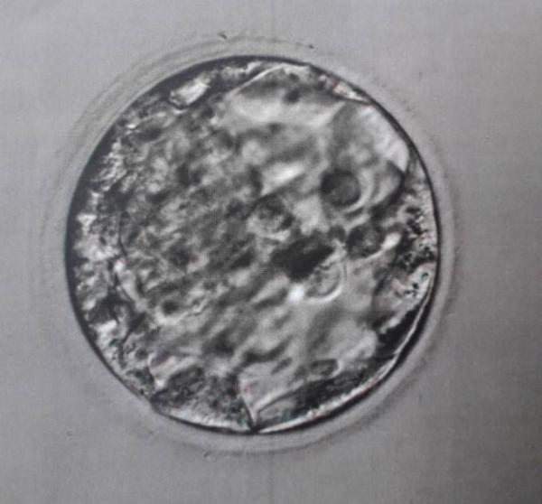 Bild zu Qualität vom Blastozysten - Kinderwunschbehandlung