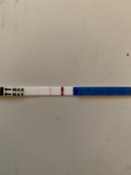 Bild zu Doch noch Hoffnung? - Kinderwunschbehandlung