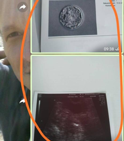 Bild zu Punkten +10 und Transfer+5 - Kinderwunschbehandlung