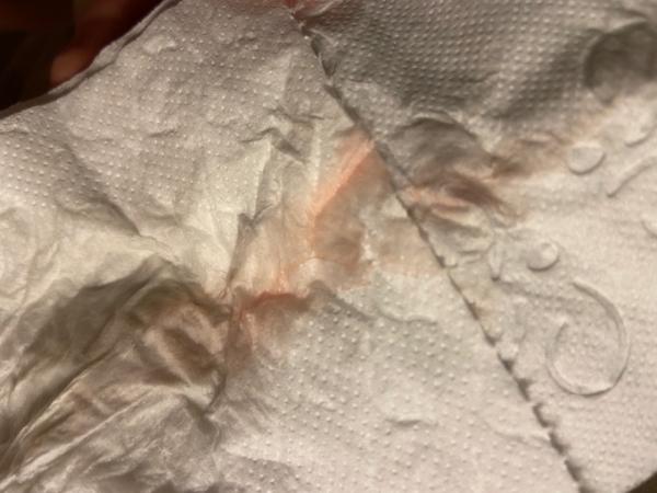 Bild zu Schwanger werden nach AS Ende 9 Woche - Kinderwunschbehandlung