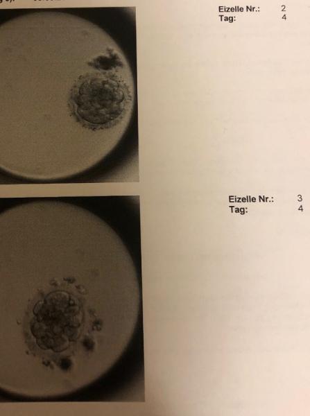 Bild zu Zellteilung PU+4 - Kinderwunschbehandlung