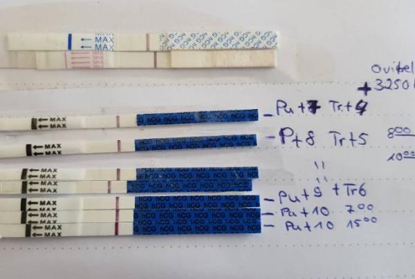 Bild zu Testreihe Pu +10 - Kinderwunschbehandlung