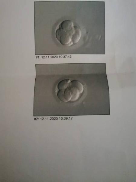 Bild zu Was ist es? - Kinderwunschbehandlung