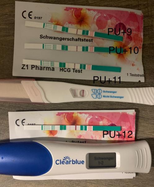 Bild zu Ich glaube ich darf mich freuen - Kinderwunschbehandlung