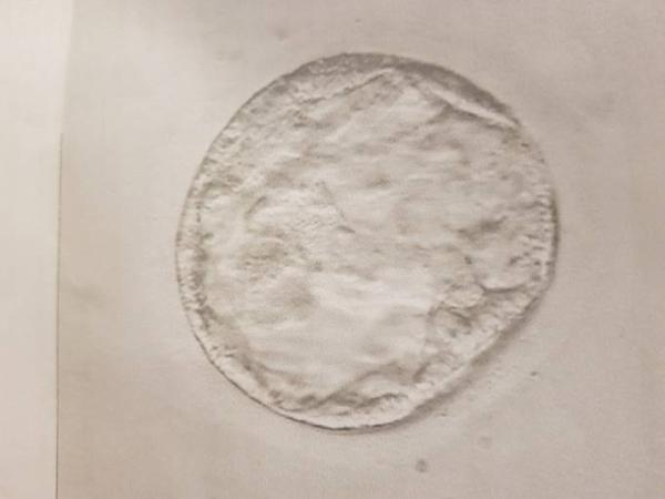 Bild zu Blastotransfer nach FG- was sagt ihr zu der Blasto?? - Kinderwunschbehandlung