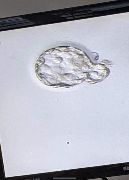 Bild zu Qualität Blastos - Kinderwunschbehandlung