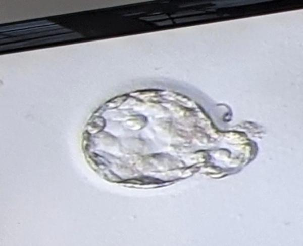 Bild zu Embryoplast? - Kinderwunschbehandlung