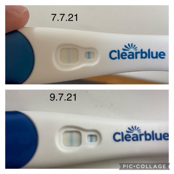 Bild zu Zyklus nach Frühabort / ICSI - Kinderwunschbehandlung