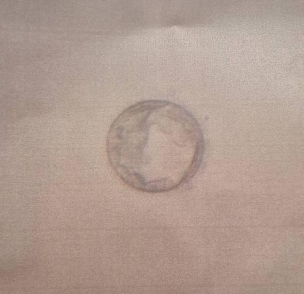 Bild zu ICSI Transfer - Kinderwunschbehandlung