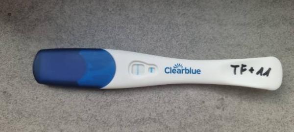 Bild zu Mensartige Blutungen aber positiv - Kinderwunschbehandlung