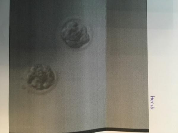 Bild zu Neuling…. Erste ICSI, TF+ 10 negativ getestet - Kinderwunschbehandlung