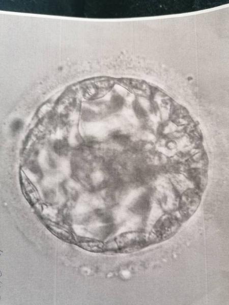 Bild zu Wie weit ist diese Blastozyste - Kinderwunschbehandlung