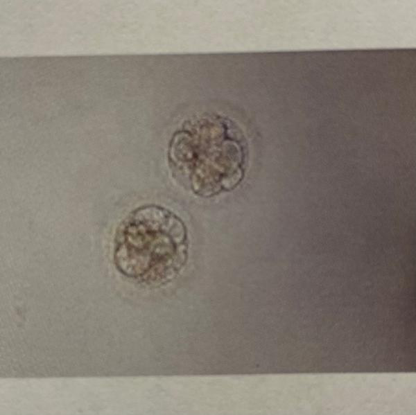 Bild zu Traurig - Kinderwunschbehandlung
