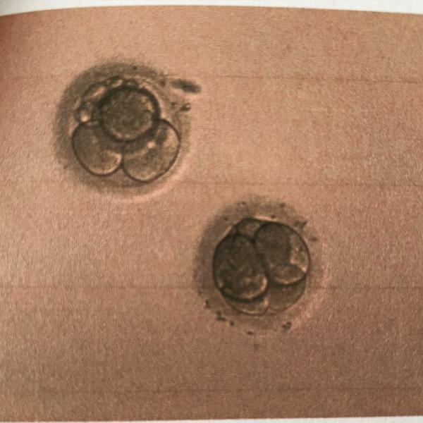 Bild zu Richtige Entscheidung? - Kinderwunschbehandlung