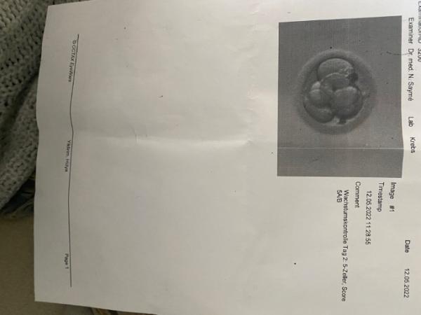 Bild zu Erste icsi Punktion 10.05.22 Transfer 12.05 wann Test möglich - Kinderwunschbehandlung