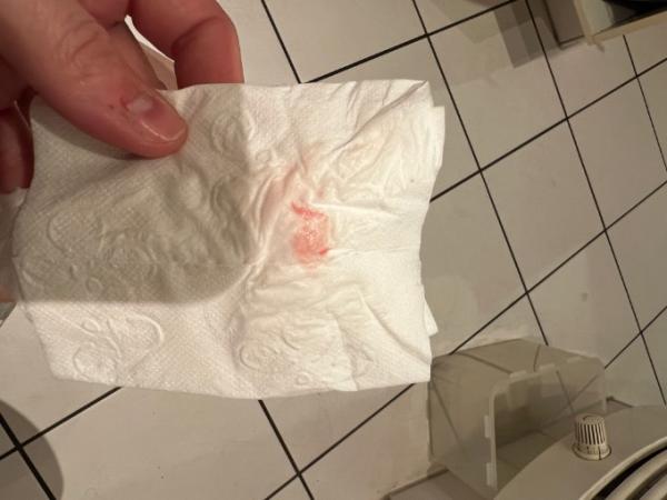 Bild zu PU+12/TF+7 Leichte hellrot/rosane Blutung beim abputzen - Kinderwunschbehandlung