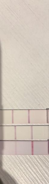 Bild zu Ovu test einmal hilfe - Kinderwunschbehandlung