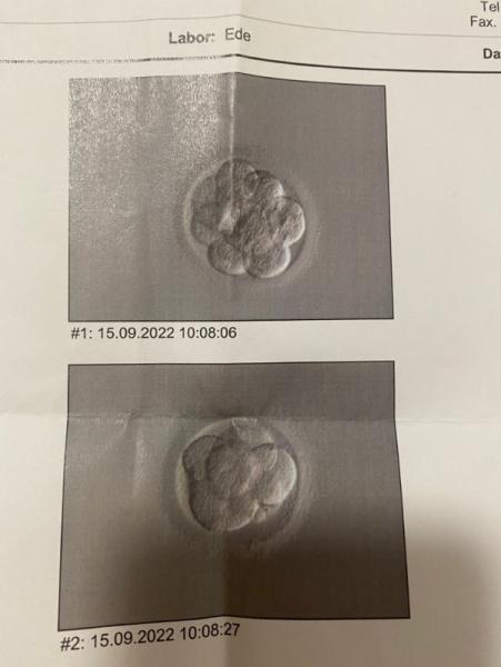 Bild zu Pu+2 Welcher Qualität haben beide? A,B o. C? - Kinderwunschbehandlung