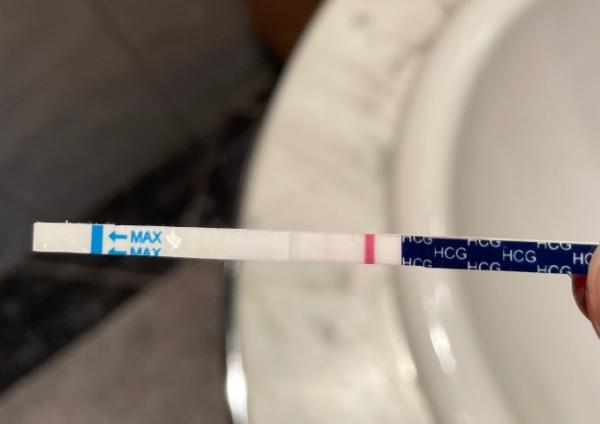 Bild zu ICSI PU+11 T+8 - Kinderwunschbehandlung