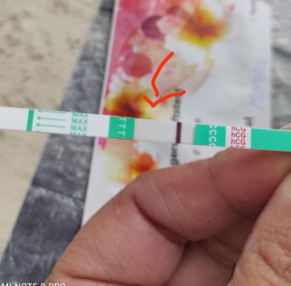 Bild zu An pu+10 und Tr +7 leicht positiv - Kinderwunschbehandlung