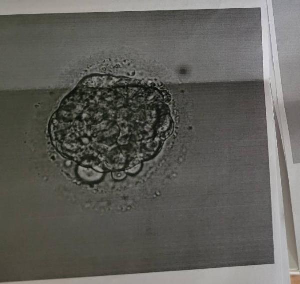 Bild zu Blasto - Kinderwunschbehandlung