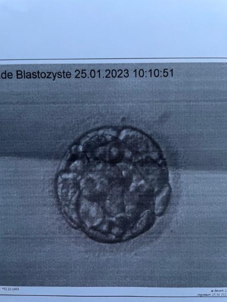 Bild zu Was sagt ihr zu der Blastozyste? - Kinderwunschbehandlung