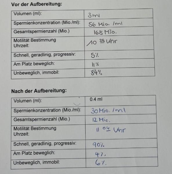 Bild zu IuI // 2 Leitfollikel —> Twins? - Kinderwunschbehandlung