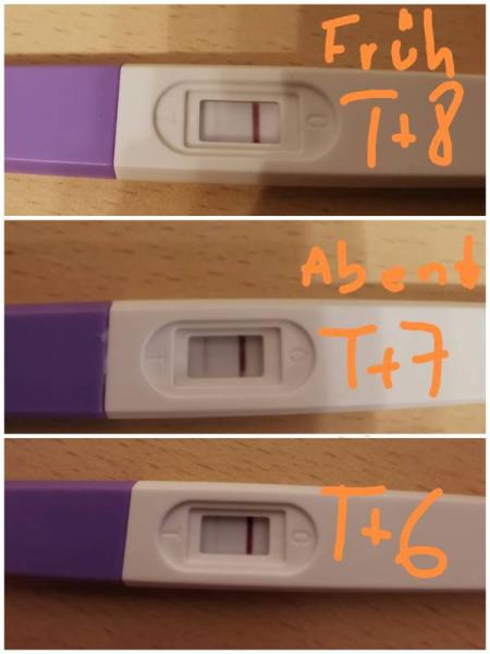 Bild zu SST positiv? - Kinderwunschbehandlung