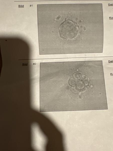 Bild zu PU+6 TF+3 - Kinderwunschbehandlung