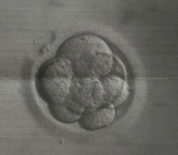 Bild zu Embryo-Tranfer + 6 keinerlei Symptome - Kinderwunschbehandlung