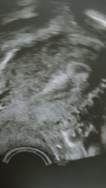 Bild zu Gbsh - Kinderwunschbehandlung