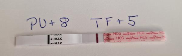 Bild zu PU+8 Tf+5 Test positiv? - Kinderwunschbehandlung