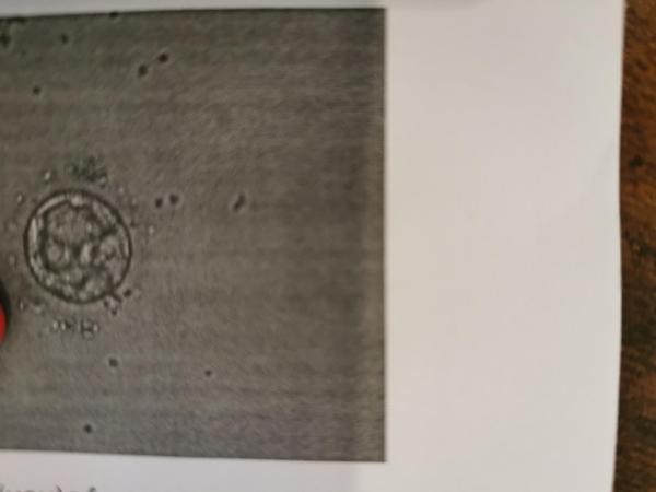 Bild zu 02BB Qualität bei Embryotransfer (Blasto) für icsi.. Erfahrungen?! - Kinderwunschbehandlung