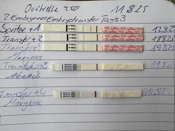 Bild zu 3 Kryotransfer von 2 Embryonen an Tag 3 - Kinderwunschbehandlung