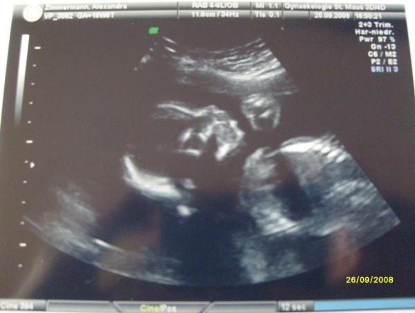 Bild zu Mal kurz zu meinem Baby :) - Kinderwunsch - was tun, um schwanger zu werden?