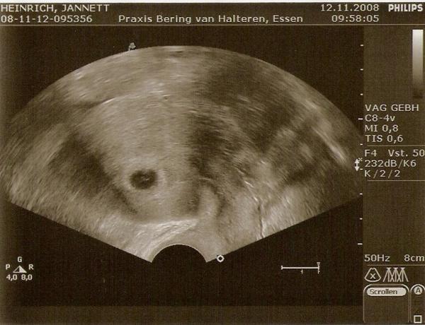 Bild zu Hallo Mädels... - Kinderwunsch - was tun, um schwanger zu werden?
