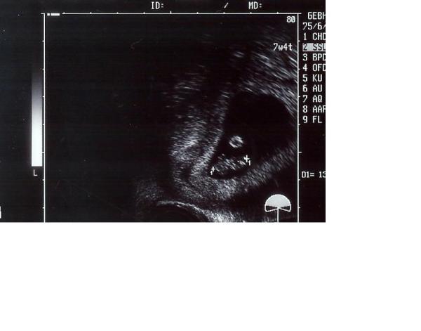 Bild zu Bin soooooooooo happy!!!!!!! - Kinderwunsch - was tun, um schwanger zu werden?