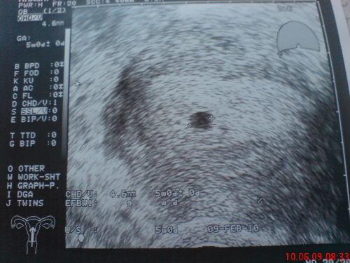 Bild zu So ihr Süssen... - Kinderwunsch - was tun, um schwanger zu werden?