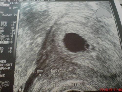 Bild zu zurück von FÄ - Kinderwunsch - was tun, um schwanger zu werden?