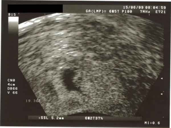 Bild zu wer Bildchen von heute früh gucken mag.... - Kinderwunsch - was tun, um schwanger zu werden?