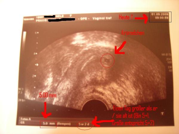 Bild zu Mut machen - Kinderwunsch - was tun, um schwanger zu werden?