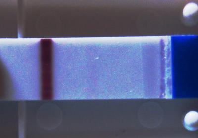Bild zu Ist der Test positiv??? - Kinderwunsch - was tun, um schwanger zu werden?