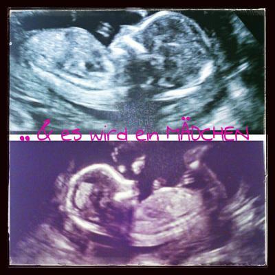 Bild zu Ich bin in der 17. SSW und würde euch gerne beistehen ;-) - Kinderwunsch - was tun, um schwanger zu werden?