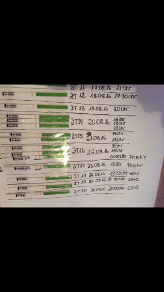 Bild zu Bitte um Erklärung OVU ES - Kinderwunsch - was tun, um schwanger zu werden?