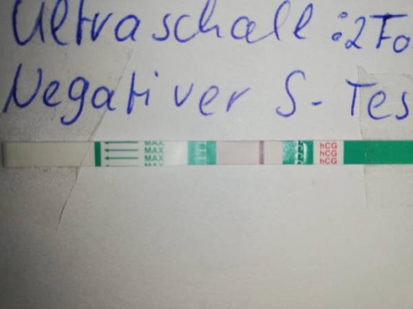 Bild zu SS Test seht ihr was? - Kinderwunsch - was tun, um schwanger zu werden?