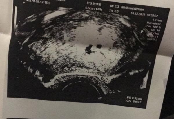 Bild zu Fruchthöhle, überfällig, alle Symptome aber jeder Test negativ - Kinderwunsch - was tun, um schwanger zu werden?